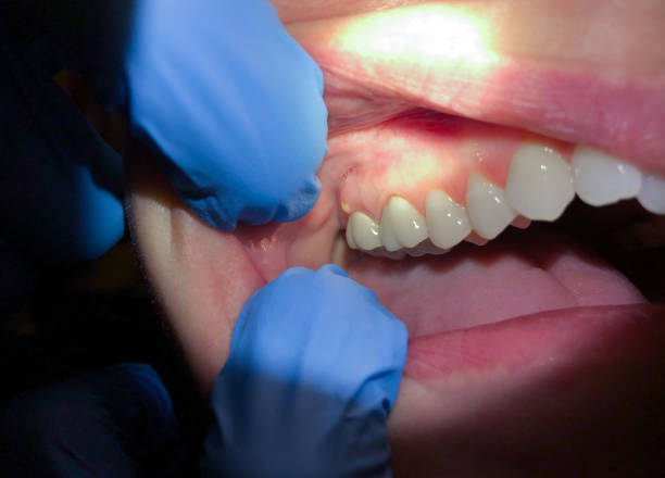 Reliable MA Emergency Dental Service Solutions